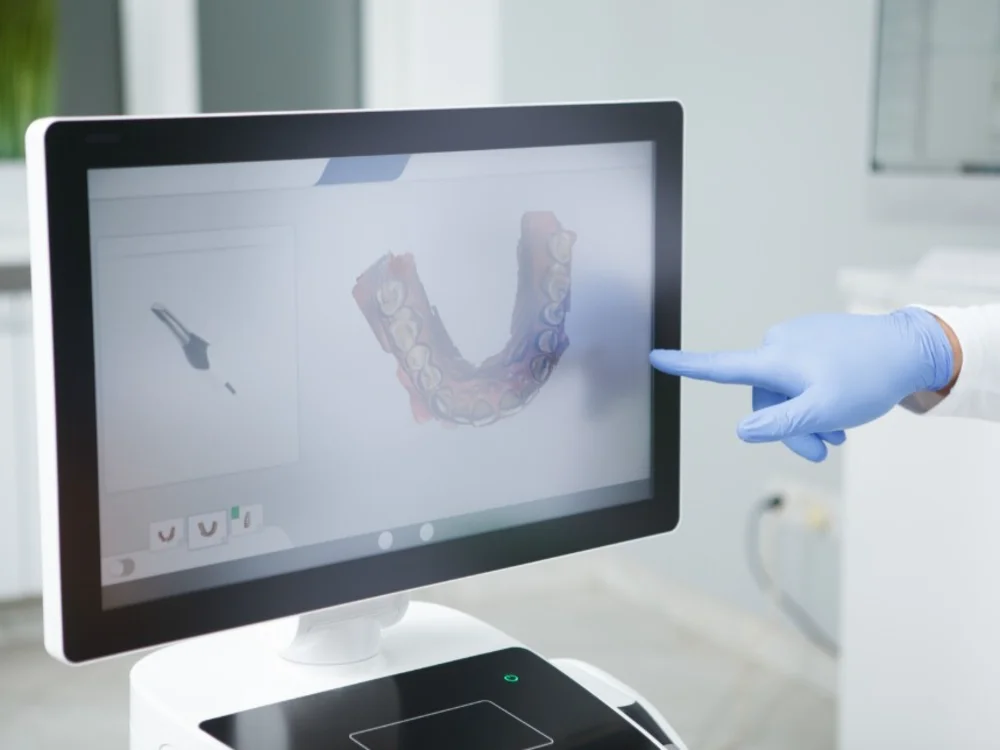 Intraoralscanner in der Praxis am Marienplatz